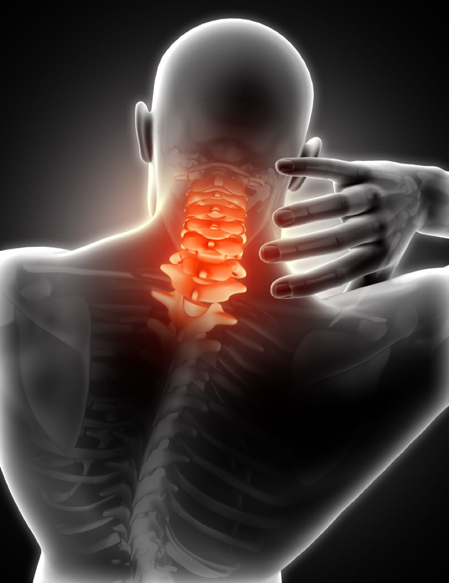 neck pain perth