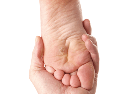 treating common foot problems
