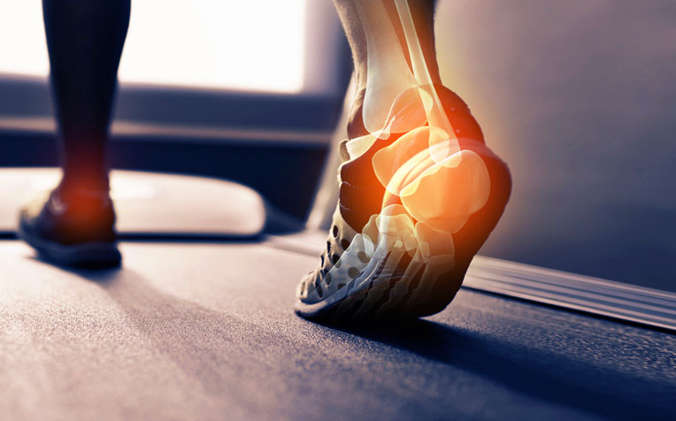 heel pain exercises